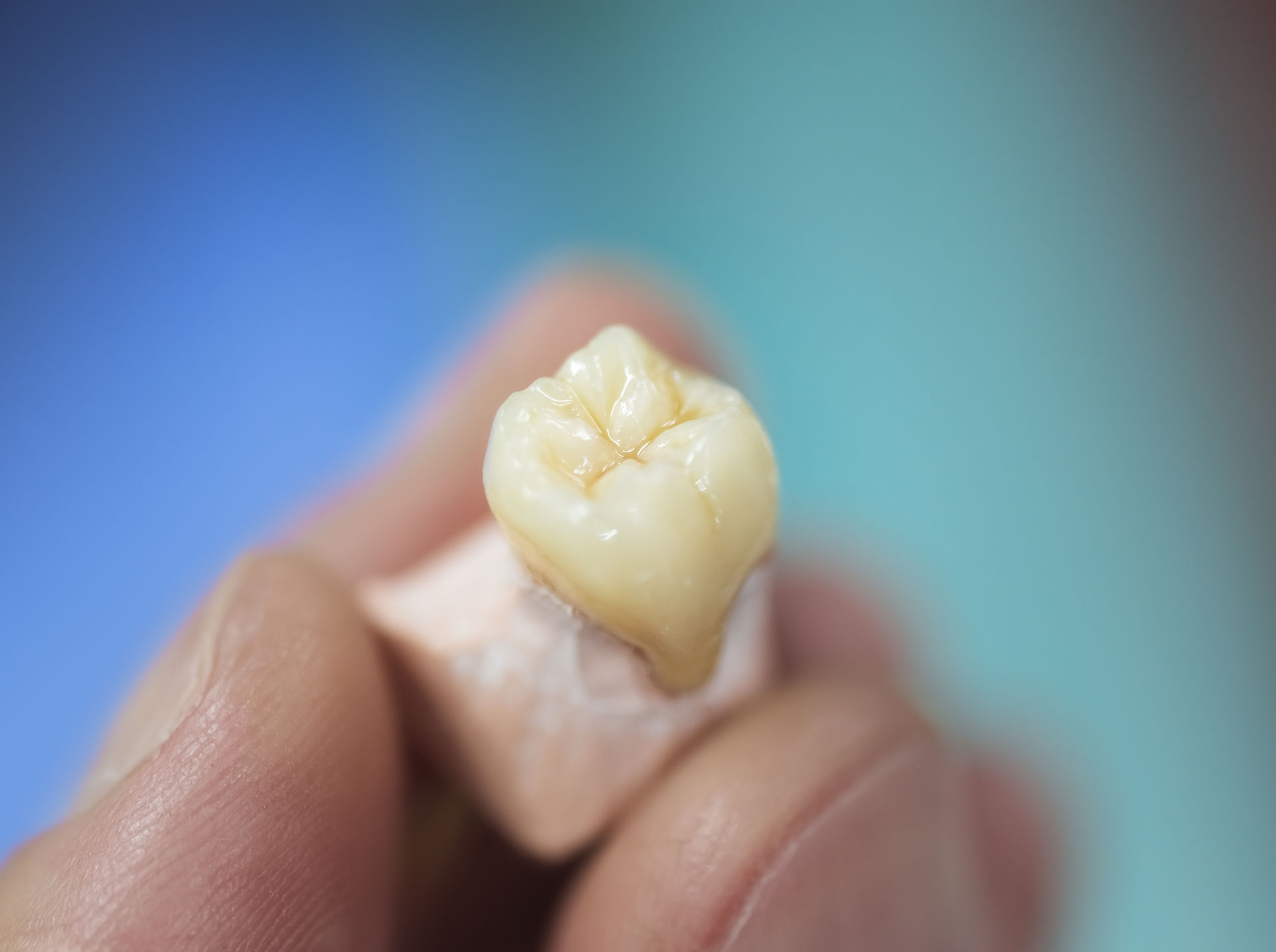 https://www.sivpdental.it/wp-content/uploads/2023/02/dental-prosthesis-2021-08-26-18-26-32-utc.jpg