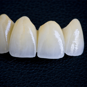 https://www.sivpdental.it/wp-content/uploads/2023/04/PROTHESE-CONJOINTE-300x300.png