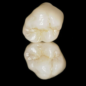 https://www.sivpdental.it/wp-content/uploads/2023/05/Couronne-full-zircone-multicouches-1-300x300.jpg
