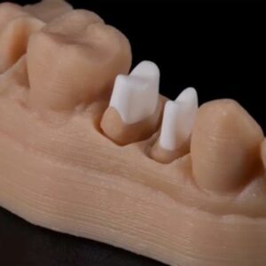 https://www.sivpdental.it/wp-content/uploads/2023/05/PHOTO-2023-08-04-11-47-49-300x300.jpg